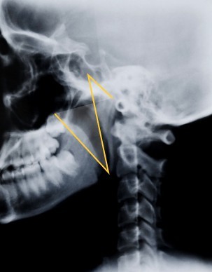 jQuery polygonal annotations